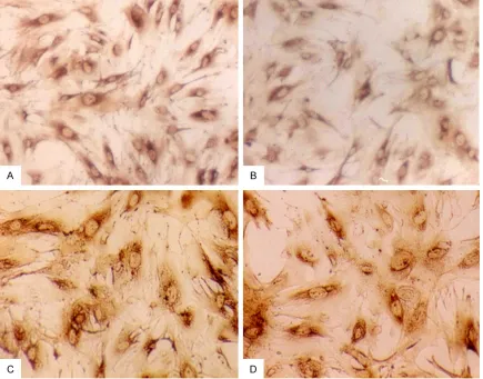 Figure 3. A: LSC-1 cells express desmin (original magnification, ×200). B: LSC-1 cells express GFAP (original magnification, ×200)