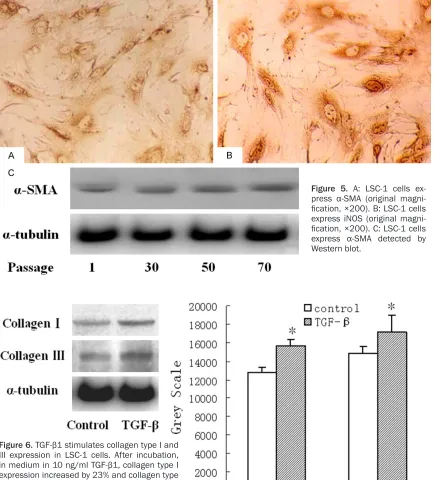 Figure 6. TGF-β1 stimulates collagen type I and III expression in LSC-1 cells. After incubation, in medium in 10 ng/ml TGF-β1, collagen type I expression increased by 23% and collagen type III expression increased by 16%
