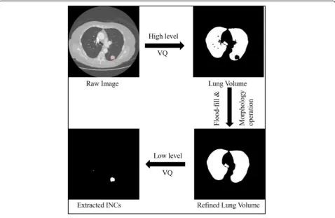 Fig. 1 Examples of the initial nodule candidates detection