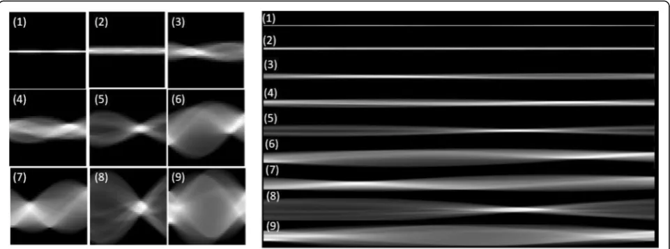Fig. 4 Examples of sinograms projected from the initial nodule candidates in Fig. 2 with different view numbers: 40 views (left) and 640views (right)