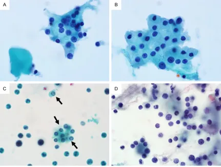 Figure 7. Cytologic features of liquid-based cytology specimens for the differential diagnoses of parathyroid and of parathyroid cells (arrows) is similar to or smaller than that of white blood cells in the background (SurePath; × thyroid lesions