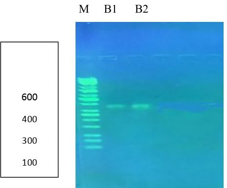 Figure 2: Electrophoresis of PCR products of the COII gene using the specific primer 