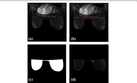 Fig. 4 Breast region segmentation steps and generating the contrast-enhanced image map including (a) the original image, (b) separationline, (c) generated mask, and (d) breast region segmented on the contrast-enhanced map