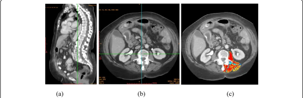 Fig. 5 Applying a convolutional neural network (CNN) algorithm (a) to automatically identify the targeted abdominal region marked inside a redframe and segmenting each selected abdominal CT slice into three groups of pixels, namely, SFA (light gray), VFA (white), and other humanorgans (dark) (b)