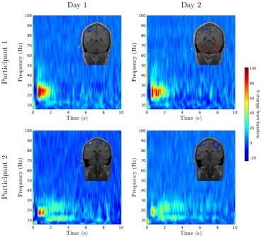 Fig. 1 Robust beta rebound forrowparticipant 1 and therepresents data from participant2