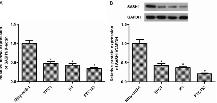 Figure 1. SASH1 expression in thyroid cancer cell lines. A. The expression levels of SASH1 mRNA were significantly decreased in TPC1, K1, and FTC133 thyroid cancer cell lines compared with that in Nthy-ori3-1 normal thyroid cell line
