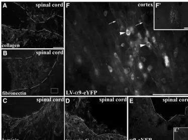 Figure 6. CNS injury induces upregulation of ECM expression but does not induce integrin localization in adult CST axons