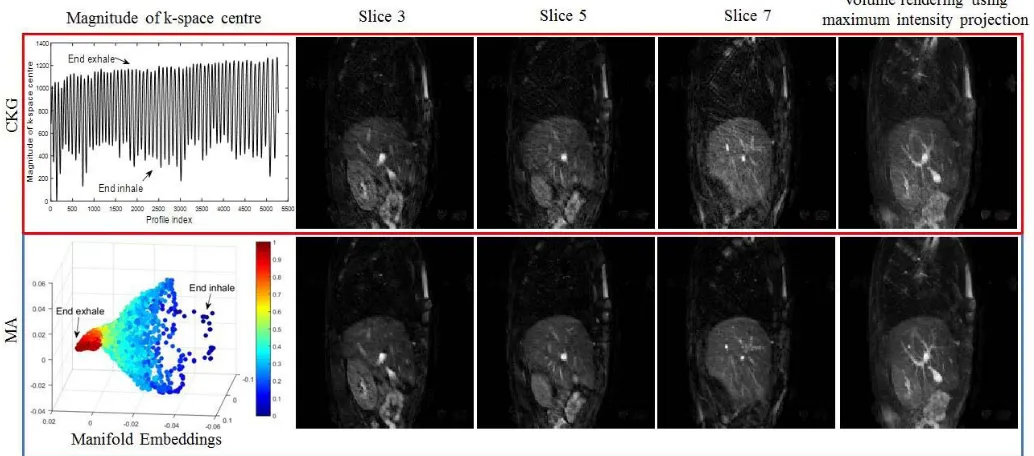 Fig. 7. Example of reconstructed 3-D in vivo data set using the CKG (top row) and the proposed MA method (bottom row)