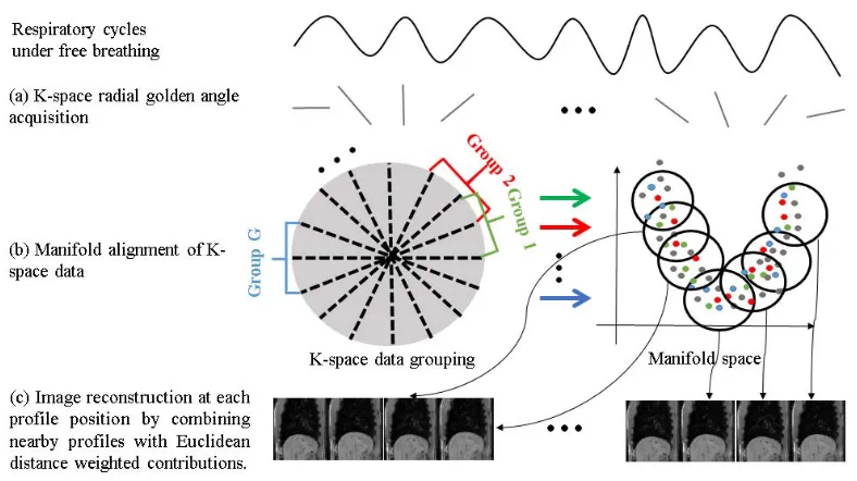 Fig. 1.Overview of the MA method for self-gating dynamic MRI with the following steps