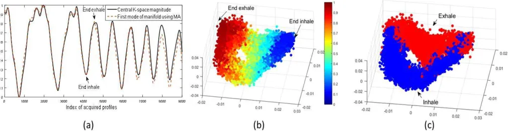 Fig. 4.(a)correlation coefﬁcient is 0.9866. Virtual navigator values of the reconstructed sequence of a 2-D synthetic data set and its corresponding ground truth