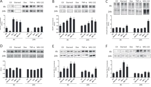 Fig. 4. Markers of muscle protein breakdown (MPB) in C2C12 cells following incubation with various treatments known to inﬂ10 ng/ml) or MG-132 (20expression