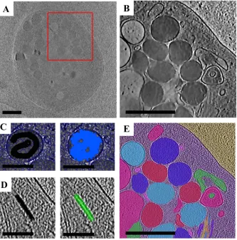 Figure 4. Processing of a cryoET Dataset using a Super-region Segmentation Strategy. 