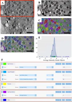 Figure 5. Analysis of a cryoSXT Dataset using the Label Splitter Tool. 