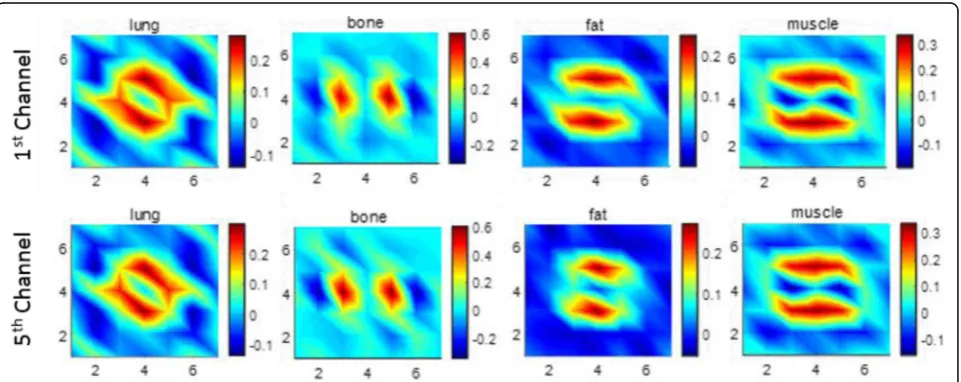 Fig. 1 Full dose computed tomography images and their segmented tissue masks. Images of first and last (5th) energy channel