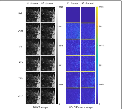 Fig. 7 Close-up views for comparison of lung region of interests reconstructed by different algorithms