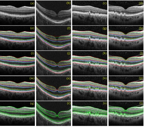 Figure 9: Comparison of diﬀerent segmentation methods on healthy and pathological 2D OCT B-scans