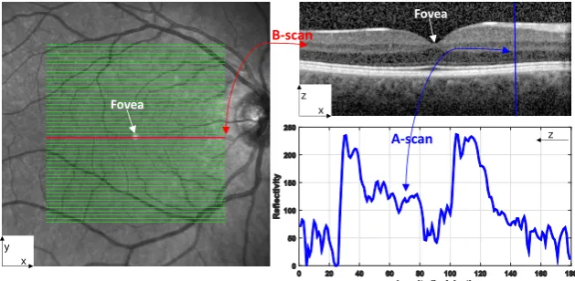 Figure 1: A en-face fundus image (left) with lines overlaid representing the locations of each B-scan within avolumetric OCT data