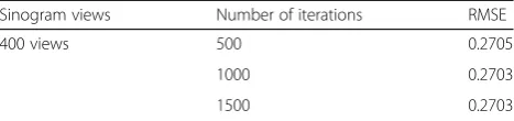 Table 4 Patient study iterative reconstruction errors in RMSE