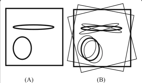 Fig. 1 Outline diagrams for images reconstructed (a) from theoriginal under-sampled sinogram and (b) frominterpolated sinogram
