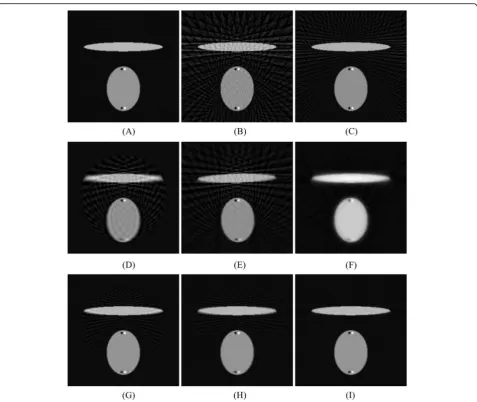 Fig. 4 FBP reconstructions reconstructed by a 360 measured views, b 60 measured views, c 120 measured views, d 360 views created from 60views by sinc function interpolation, e 360 views created from 60 views by linear interpolation, f 360 views created from 60 views by proposeddeformation method, g 360 views created from 120 views by sinc function interpolation, h 360 views created from 120 views by linearinterpolation, and i 360 views created from 120 views by proposed deformation method