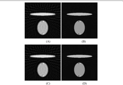 Fig. 6 Absolute error between the estimated sinogram and the true sinogram, usingmethod, and a linear interpolation method, b sinc function interpolation c non-rigid deformation method