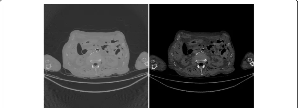 Fig. 7 (Gold standard) FBP reconstruction using full sinogram with angular gap = 0.3° (1200 views over 360°)