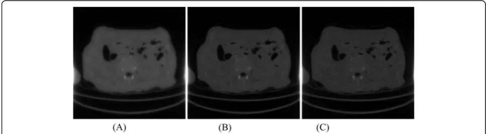 Fig. 12 Iterative Landweber algorithm reconstruction using 400 views with iteration number of a 500, b 1000, and c 1500, respectively