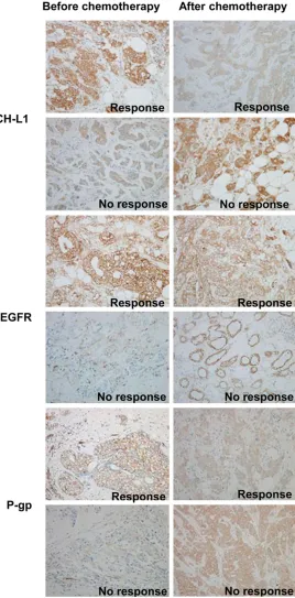 Figure 4. Expression of UCH-L1, EGFR and P-gp before and after chemo-therapy was measured by immunohistochemistry in patients’ tissues