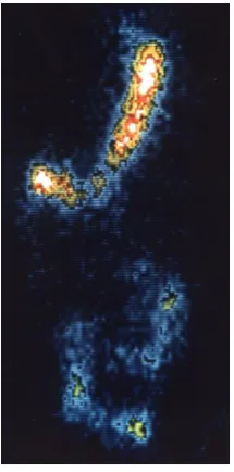 Figure 1: Emptying following dispersion of a capsule containing micronised Amberlite labeled with Indium-111
