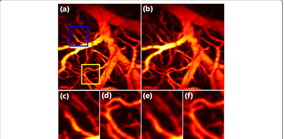 Fig.The structure of the CNN in this work is illustrated in 2. The images with the motion artifacts used fortraining were obtained from the ground-truth image