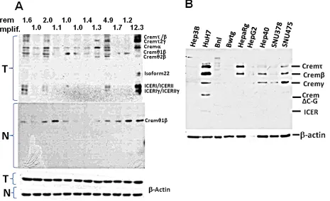 Figure 6: Expression of the Crem protein isoforms in murine liver at tumor stage and in human and murine HCC cells