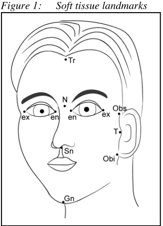 Table 3:Mean and SD (in millimeter) of linear distances (Ear measurement and distance to the eye andthe nose) comparing between 150 male and 104 female subjects