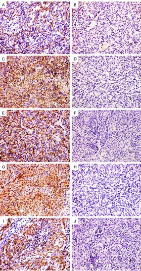 Figure 3. Representative immunohistochemical staining of CD29, CD44, nestin, CD133 and ALDH1 expression in hemangiosarcoma tissues
