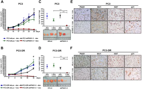 Figure 6: PIAS1 knockdown results in significantly reduced tumor growth of PC3 and PC3-DR xenograftsin vivo