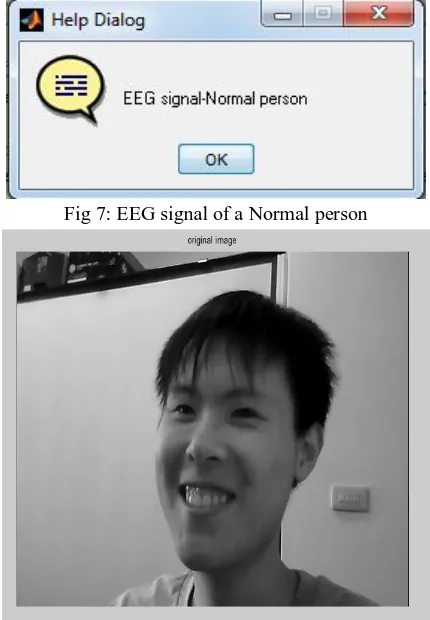 Fig 7: EEG signal of a Normal person 