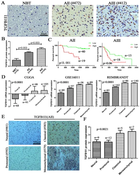 Figure 4: TGFB1I1 protein increased with grade progress and be associated with TCGA subtypes