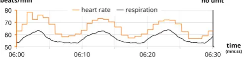 Figure 2. HRV and RSA. Stepped curve (above)curve (below) = HR; smooth = RSP trace.
