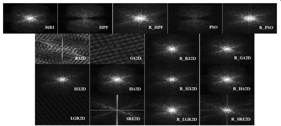 Fig. 8 Comparative study across filtering techniques. Top row (from left to right): MRI, HPF, reconstructed MRI through HPF (R_HPF), PSO-basedHPF, and reconstructed MRI through PSO (R_PSO)