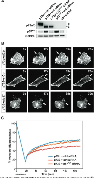 Figure 4: p73β regulation of the actin cytoskeleton dynamics is dependent on induction of p57Kip2controls