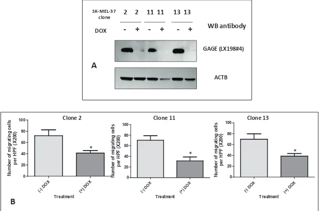 Figure 5: A: Western blot analysis of GAGE expression in double-stable Tet-On/GAGE shRNAmir clones, untreated (- DOX) or treated with doxycycline (+ DOX)