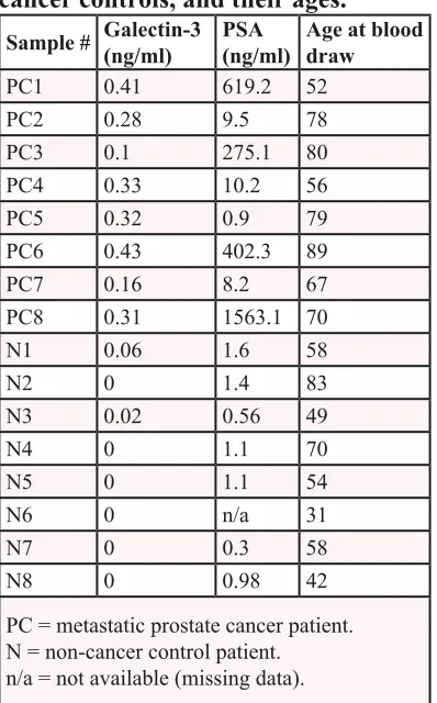table 1: Level of galectin-3 and PsA in the sera of Pca patients and non-cancer controls, and their ages