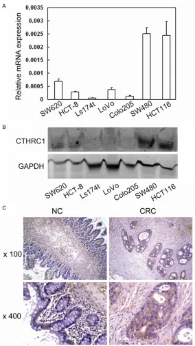Figure 1. CTHRC1 expression in CRC cell lines. A: Analysis of CTHRC1 mRNA in CRC cell lines