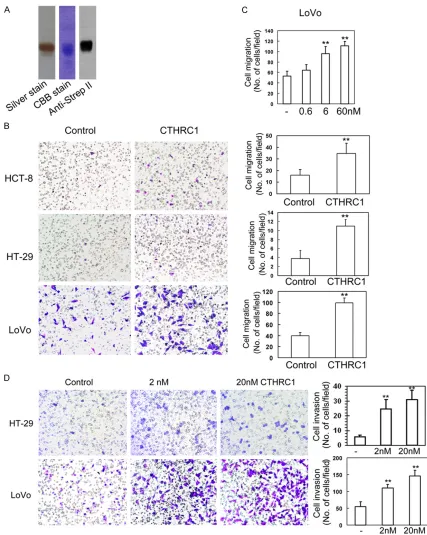Figure 2. Recombinant CTHRC1 promotes CRC cell migration. A: I Characterization of affinity purified CTHRC1 by silver staining, CBB staining and western blot