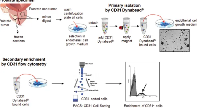 Figure 1: Schematic representation of prostate non-tumor and tumor endothelial cell isolation and enrichment