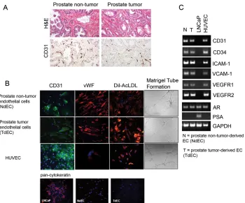 Figure 2: Characterization of primary cultures of endothelial cells isolated from NdECs and TdECs prostate tissue