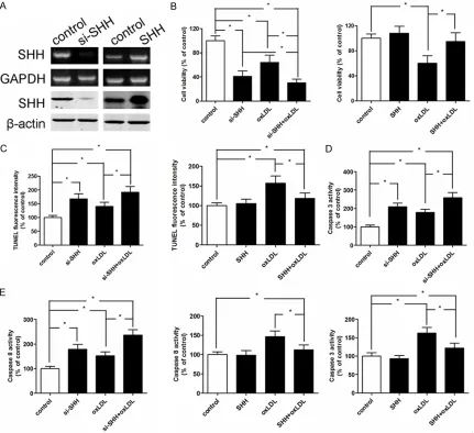Figure 4. The mRNA and protein expression of SHH were measured by real-time PCR and western blotting respec-tively when MBMECs were treated with SHH-siRNA and SHH-transfected (A)