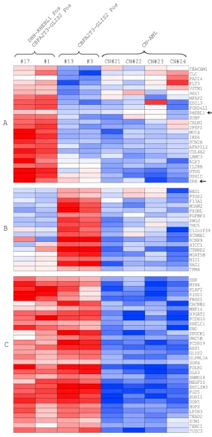 Figure 3: Analysis of gene expression profile of DHH-RHEBL1-positive patients. Heatmap of the top 30 differentially expressed genes in DHH-RHEBL1-positive patients compared with the patients harboring the CBFA2T3-GLIS2 fusion only and CN-AML patients