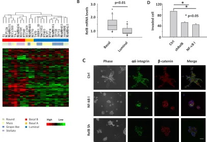 Figure 5: Expression of disorganization genes and activation of the NF-κB pathway are associated with aggressive 3D phenotypes of multiple breast cancer cell lines