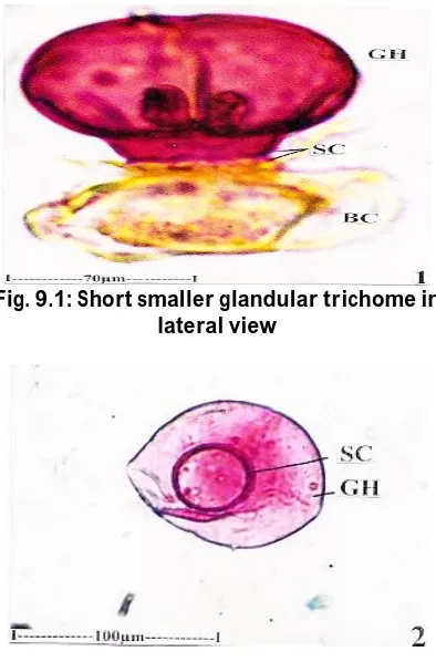 Fig. 9.1: Short smaller glandular trichome in  lateral view 