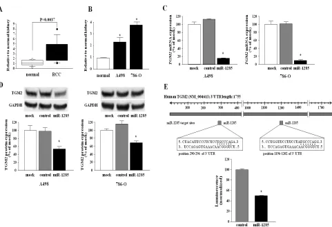 Figure 3: miR-1285 directly regulates TGM2 in RCC cells. (A) Expression level of TGM2 mRNA in clinical RCC cell specimens